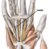 trigger-finger
