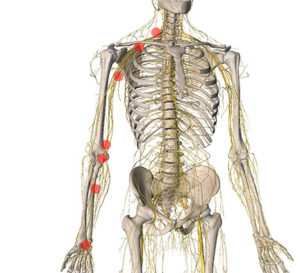 Exploring Upper Limb Neurodynamics - Academy of Clinical Massage