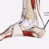 Location of Haglund's deformity or "pump bump"