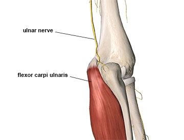 Posterior view of the elbow showing ulnar nerve coursing under flexor carpi ulnaris muscle