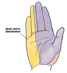 Sensory distribution of the ulnar nerve