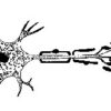 Exploring Charcot Marie Tooth Disease Wallerian degeneration