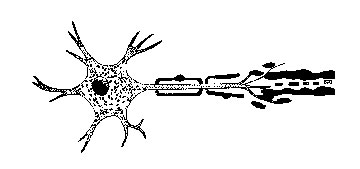 Wallerian degeneration