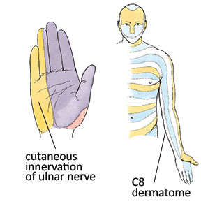 Cutaneous innervation and dermatome comparison