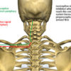 The Myth of the Pain Receptors Schematic of Gate Theory