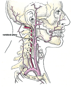 side view of vertebral arteries