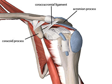 Hooked on Shoulder Pain - Academy of Clinical Massage