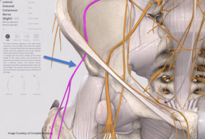 lateral femoral cutaneous nerve