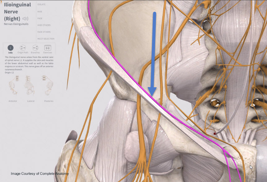 ilioinguinal nerve - Academy of Clinical Massage