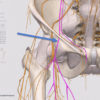 Alternate Causes of Anterior Hip Pain blog 72-5