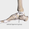 Figure 2
Four ligaments of the deltoid group on the medial ankle
Image is from 3D4Medical’s Complete Anatomy application 
