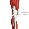 Image 1
Infrapatellar tendon is often listed as the patellar ligament because of its connection between the patella and tibia
Image is from 3D4Medical’s Complete Anatomy application 