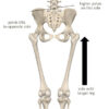 Image 5
Leg length discrepancy and SI joint dysfunction. 
Longer leg produces higher pelvis on that side and tilt of pelvis to opposite side.
Image courtesy of Complete Anatomy 