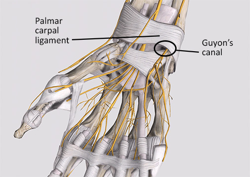 image of the ulnar nerve as it passes through Guyon's canal